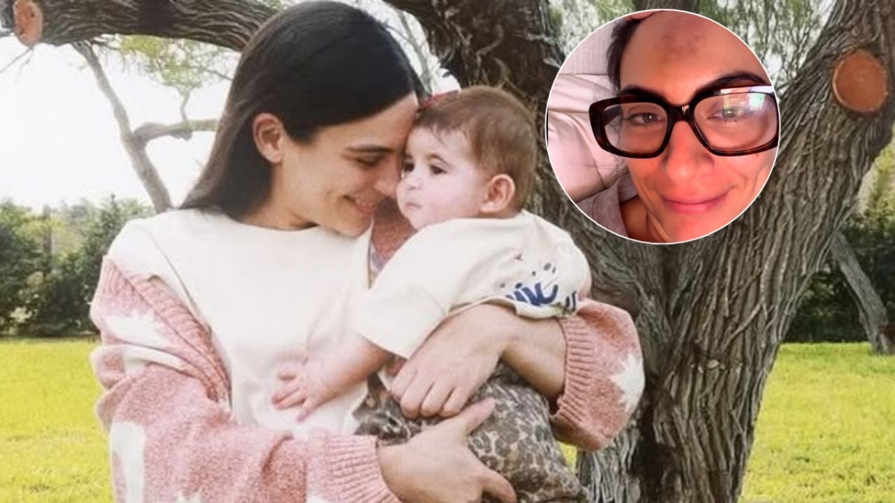 Ana Brenda Contreras y su accidente jugando con su hija: Un eco entre las mamás